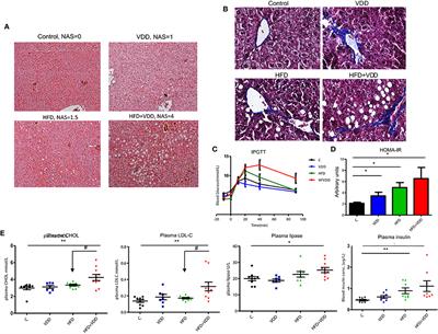 Vitamin D Signaling through Induction of Paneth Cell Defensins Maintains Gut Microbiota and Improves Metabolic Disorders and Hepatic Steatosis in Animal Models